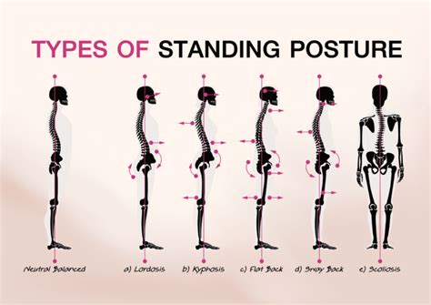 Its All About Posture Sarum Physio Salisburys Premier Physio And