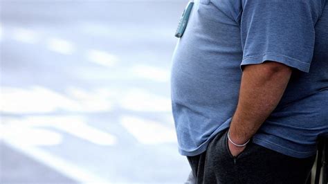 Obese People In Wales Denied Life Saving Treatment Bbc News