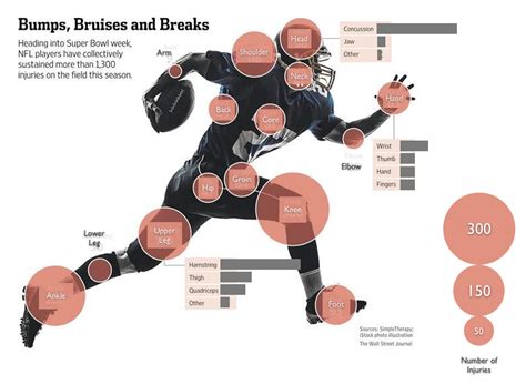 American Football Infographic Concussions Bits And Bobs Injury