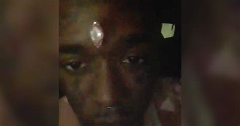 Lil Uzi Vert Says Fans Ripped 24m ‘vision Diamond From His Forehead