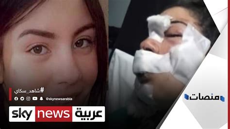 ياريته ضربها ضرب عادي ولميس الحديدي ترد منفعلة. محامي إسراء عماد يكشف تفاصيل مثيرة عن القضية وتورط المزيد ...