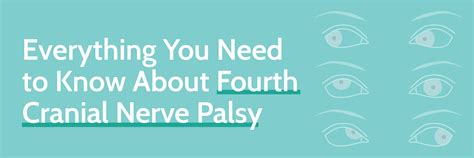 Everything You Need To Know About Fourth Cranial Nerve Palsy
