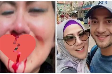 Foto Venna Melinda Penuh Darah Setelah Ferry Irawan Kdrt Viral Barang Bukti Jadi Sorotan