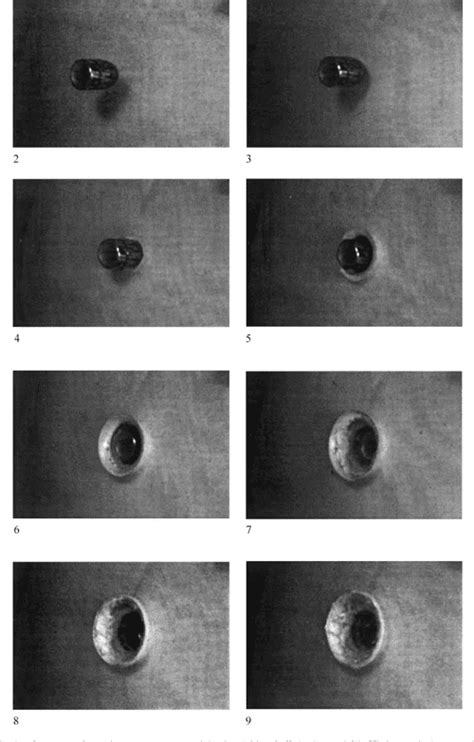 Figure 4 From A Study Of The Morphology Of Gunshot Entrance Wounds In