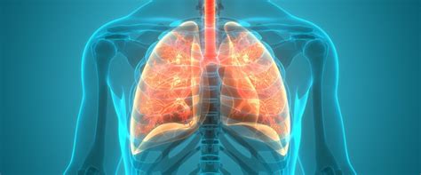 Zapalenie Płuc Objawy Diagnoza Leczenie Portal Dozpl