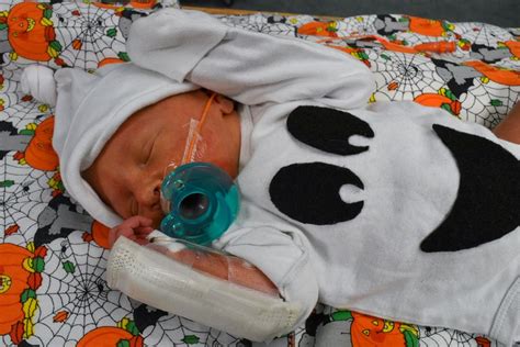Nicu Babies Celebrate Halloween With Adorable Costumes Abc News