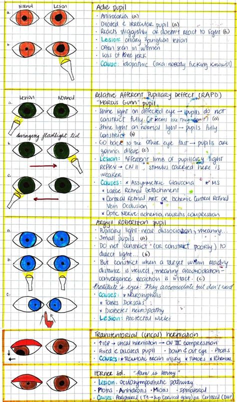 Pupillary Abnormalities Optometry Education Eye Facts Optometry School