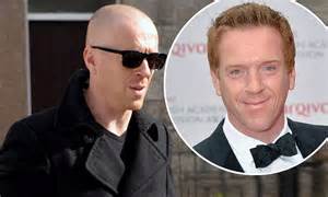 Damian Lewis Undergoes A Dramatic Transformation As He Swaps His Fiery