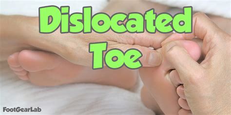 Dislocated Toe Symptoms Causes Treatment And Recovery Time