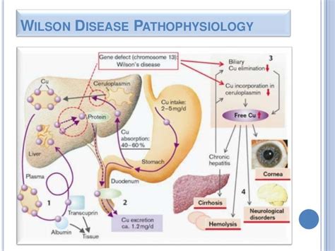 Wilsons Disease