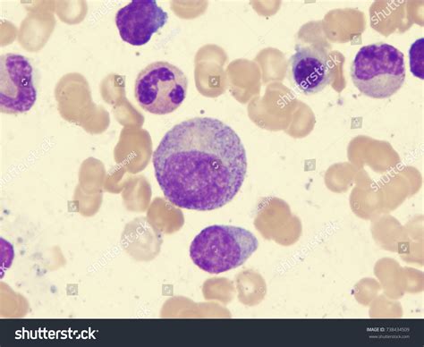 Myelocyte Showing Dawn Neutrophilia Stock Photo 738434509 Shutterstock
