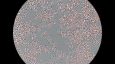 Leukocytes Microscope Images Micropedia