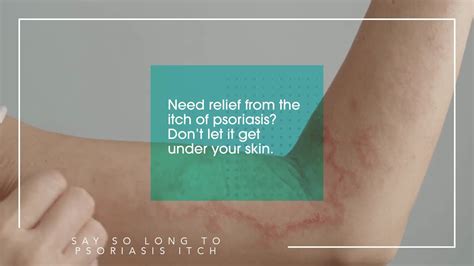 Say So Long To Psoriasis Itch Kelsey Seybold Clinic