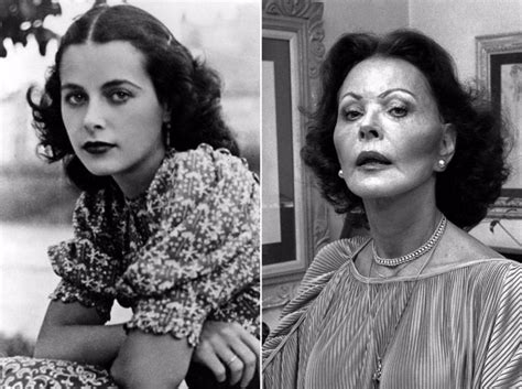 If we look at her previous and current . 11 Classic Hollywood Stars Who Had Plastic Surgery ...