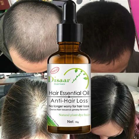 100 New High Quality 30ml Hair Care Essential Oil Moisturizing Nourish Scalp Smooth Dry Repair