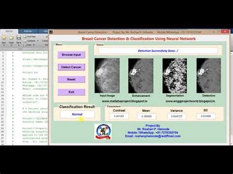 Thermogram ·computational geometry ·graph theory. Breast Cancer Detection using Neural Network - YouTube