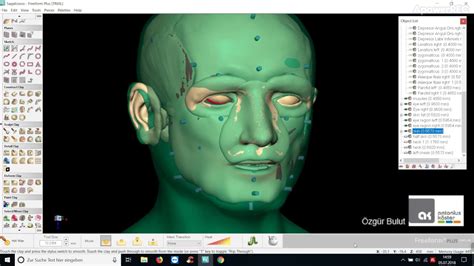 Facial Reconstructionpart2 Youtube