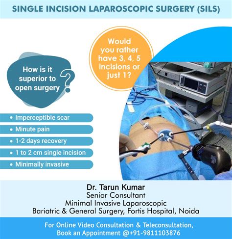Dr Tarun Kumar Surgeon Single Incision Laparoscopic Surgery Sils