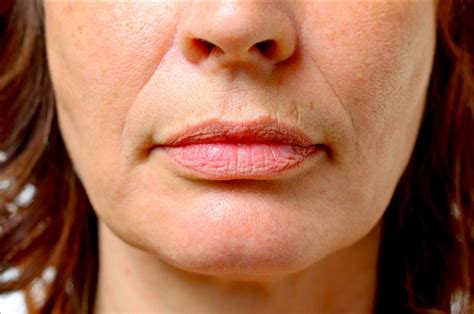 Sagging Jowls How To Get Rid Of Jowls Dr Haus Dermatology