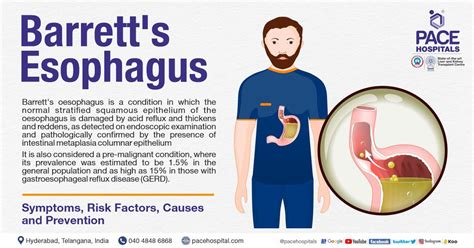 Barrett S Esophagus Symptoms Causes Types And Complications