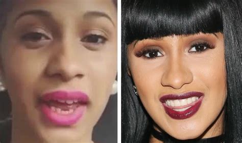 Did Cardi B Get Her Teeth Fixed See Before And After Pictures