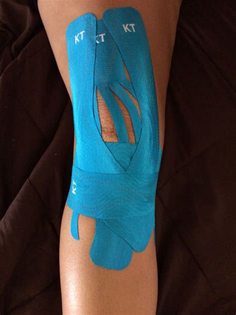 Kt Tape On Knee After Acl Reconstruction And Meniscus Repair Beats The
