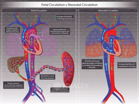 Fetal Circulation V Neonatal Circulation Trial Exhibits Inc