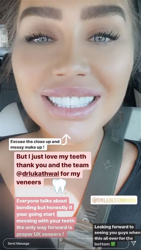 Lauren Goodger Shows Off Dazzling New Veneers After Revealing She Has