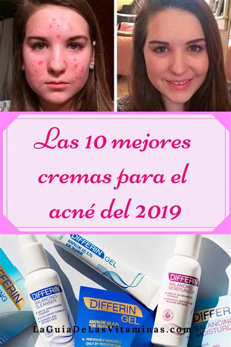Comencemos con las más populares primero, para llegar a las más desconocidas o que no se ven tan seguido. Las 10 mejores cremas para el acné del 2018 | La Guía de ...