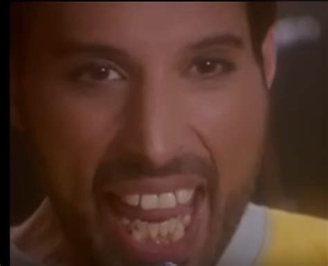 Why Didnt Freddie Mercury Get His Teeth Fixed Celebrityfm 1 Official Stars Business