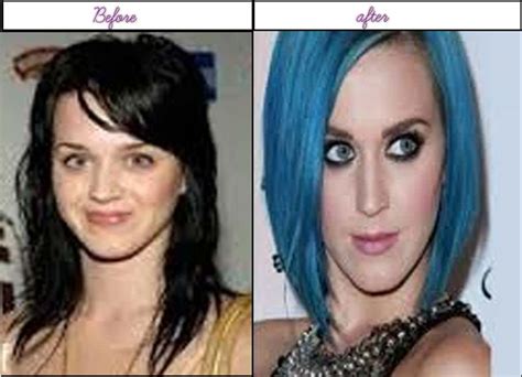 After Before Plastic Surgery Photos Of Katy Perry She Looks Astounding