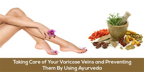 Taking Care Of Your Varicose Veins And Preventing Them By Using