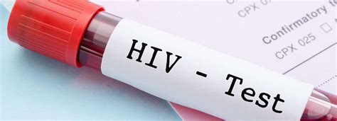 hiv testing singapore rapid hiv screening cross street