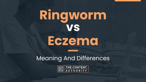 Ringworm Vs Eczema Meaning And Differences