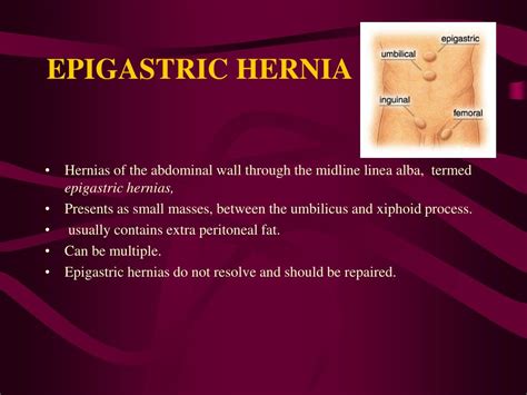 Ppt Abdominal Wall Defects Powerpoint Presentation Free Download