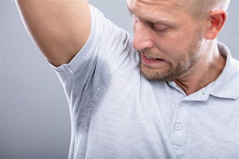 Excessive Sweating Treatment Aesthetics And Botox Clinic Southampton