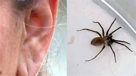 Spider Shocker Brown Recluse Found Inside Womans Ear