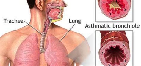 Hop on to get the meaning of gsc. How to calculate a Glasgow Coma Scale (GCS) score - First ...