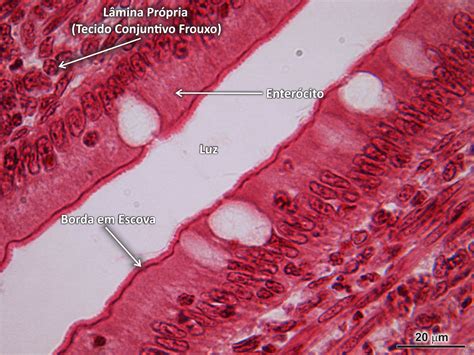 Tecido Epitelial Do Intestino Grosso
