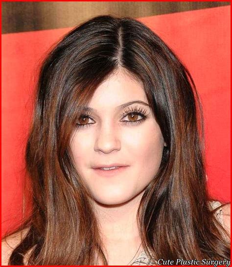 Kylie jenner before plastic surgery you can find fascinating photos! Kylie Jenner Plastic Surgery Transformation - Celebrities ...
