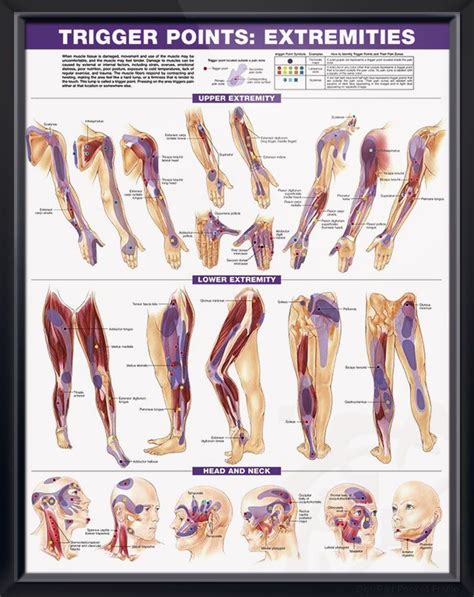 Trigger Points Torso And Extremities Chart Pair X Trigger Points