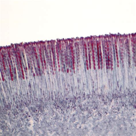 Cup Fungus Apothecium Sec 12 µm Microscope Slide Carolina