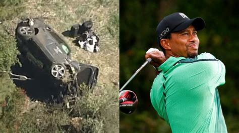 Tiger Woods Injury Update Multiple Leg Fractures Stabilized With Rod