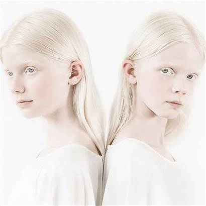Albino Twins Marie Portrait Anne Vang Stilleben