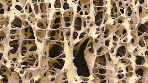 Bone Tissue Animated Coloured Scanning Electron Micrograph Sem Of