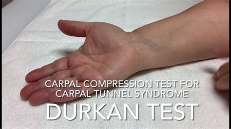 Durkan Test For Carpal Tunnel Syndrome Youtube