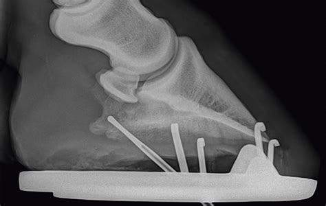 A Foot Abscess Can Create A Painful Build Up Of Pus — And The Prospect