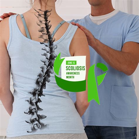 How Physical Therapists Treat Scoliosis Optimum Wellness Centers