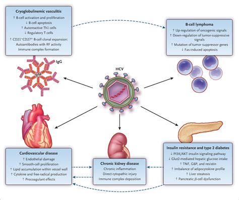 Core Concepts Extrahepatic Conditions Related To Hcv Infection