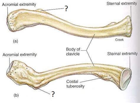 Conoid Tubercle Clavicle Julievaquera Flickr